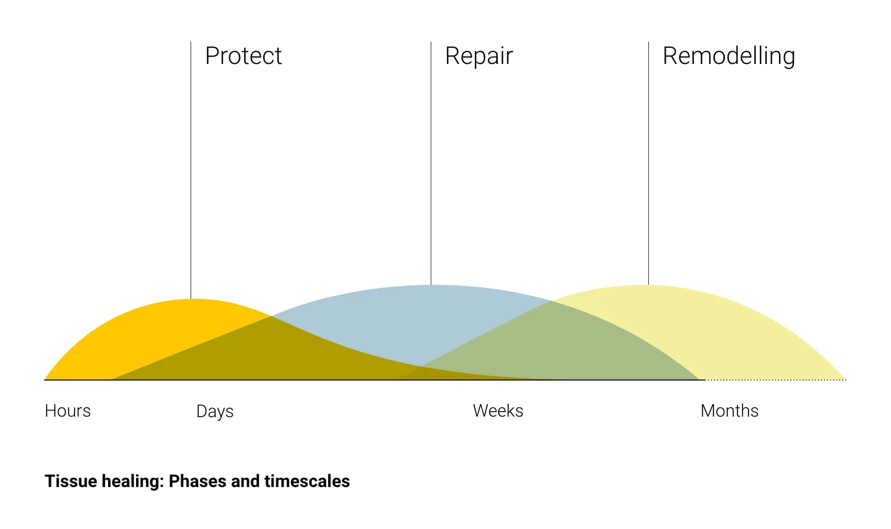 Infographic shows three phases of soft tissue injury recovery of protect, repair and remodelling